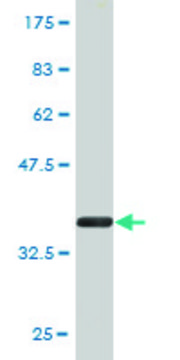 Monoclonal Anti-NAGLU antibody produced in mouse clone 1B7, purified immunoglobulin, buffered aqueous solution