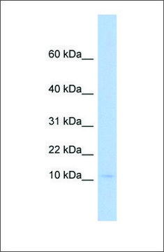 Anti-PLAC9 antibody produced in rabbit affinity isolated antibody