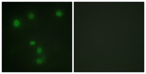 Anti-Retinoblastoma antibody produced in rabbit affinity isolated antibody