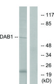 Anti-DAB1 antibody produced in rabbit affinity isolated antibody