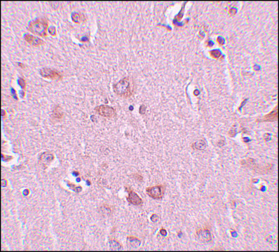 Anti-PLEKHM2 antibody produced in rabbit affinity isolated antibody, buffered aqueous solution