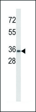 ANTI-UPK1A (C-TERM) antibody produced in rabbit IgG fraction of antiserum, buffered aqueous solution