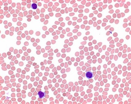 May-Grünwald&#8242;曙红-亚甲基蓝溶液改性 for microscopy