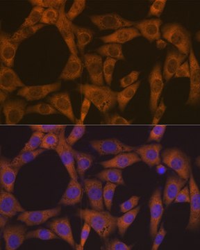 Anti-CAD Antibody, clone 0O8D6, Rabbit Monoclonal