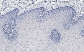 Anti-Rac1 Antibody, clone 23A8 ZooMAb® Mouse Monoclonal recombinant, expressed in HEK 293 cells