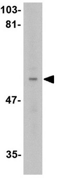 Anti-LGI4 Antibody from rabbit, purified by affinity chromatography