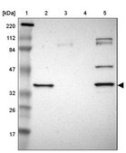 Anti-SDSL antibody produced in rabbit Prestige Antibodies® Powered by Atlas Antibodies, affinity isolated antibody, buffered aqueous glycerol solution