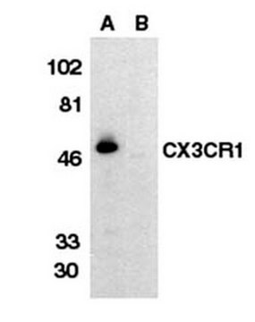 Anti-C-X-X-X-C Chemokine Receptor 1 Antibody, extracellular loop Chemicon&#174;, from rabbit