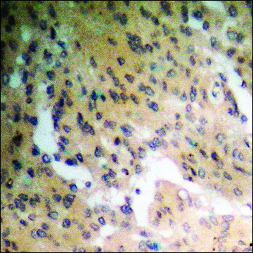 Anti-phospho-Parkin (pSer131) antibody produced in rabbit affinity isolated antibody