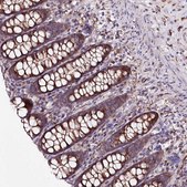 Anti-WWC1 antibody produced in rabbit Prestige Antibodies® Powered by Atlas Antibodies, affinity isolated antibody, buffered aqueous glycerol solution