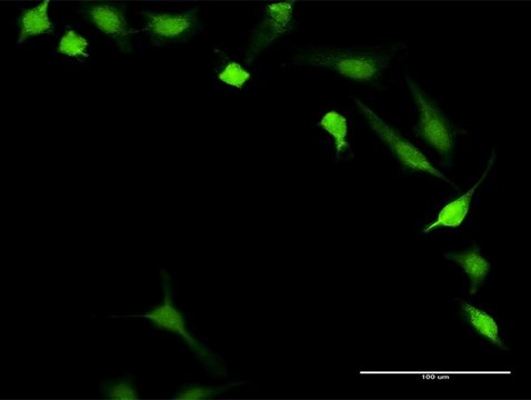 Anti-PPP3R1 antibody produced in rabbit purified immunoglobulin, buffered aqueous solution