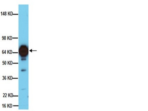 Anti-Tyrosine Hydroxylase Antibody, clone 2/40/15 clone 2/40/15, Chemicon&#174;, from mouse