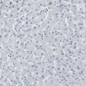 Anti-RTN3 antibody produced in rabbit Prestige Antibodies® Powered by Atlas Antibodies, affinity isolated antibody, buffered aqueous glycerol solution
