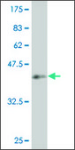 ANTI-SMAD4 antibody produced in mouse clone 1A5, purified immunoglobulin, buffered aqueous solution