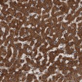 Anti-USP47 antibody produced in rabbit Prestige Antibodies® Powered by Atlas Antibodies, affinity isolated antibody, buffered aqueous glycerol solution, ab2