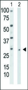 Anti-TK2 (N-term) antibody produced in rabbit IgG fraction of antiserum, buffered aqueous solution