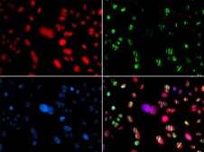 Anti- RAG2 antibody produced in rabbit