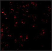 Anti-Bcl-10 antibody produced in rabbit affinity isolated antibody, buffered aqueous solution