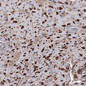 Anti-ALKBH7 antibody produced in rabbit Prestige Antibodies® Powered by Atlas Antibodies, affinity isolated antibody, buffered aqueous glycerol solution