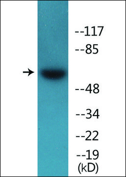 Anti-phospho-Src (pTyr418) antibody produced in rabbit affinity isolated antibody