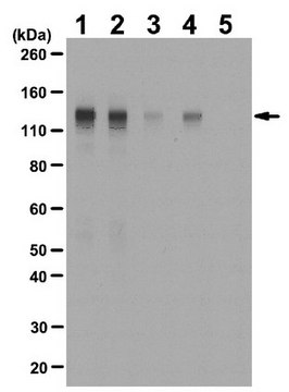 抗phospho-FGFR-1 (Tyr653/Tyr654)抗体 from rabbit, purified by affinity chromatography