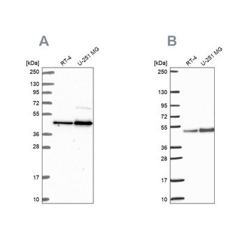 Anti-ARFGAP1 antibody produced in rabbit Prestige Antibodies&#174; Powered by Atlas Antibodies, affinity isolated antibody, buffered aqueous glycerol solution