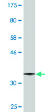 Monoclonal Anti-UGCG antibody produced in mouse clone 1E5, purified immunoglobulin, buffered aqueous solution