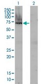 Monoclonal Anti-AFP antibody produced in mouse clone 1G7, purified immunoglobulin, buffered aqueous solution