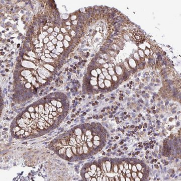 Anti-ATP13A2 antibody produced in rabbit Prestige Antibodies&#174; Powered by Atlas Antibodies, affinity isolated antibody, buffered aqueous glycerol solution