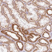 Anti-IMMT antibody produced in rabbit Prestige Antibodies® Powered by Atlas Antibodies, affinity isolated antibody, buffered aqueous glycerol solution