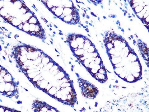 Anti-PDK2 antibody produced in rabbit