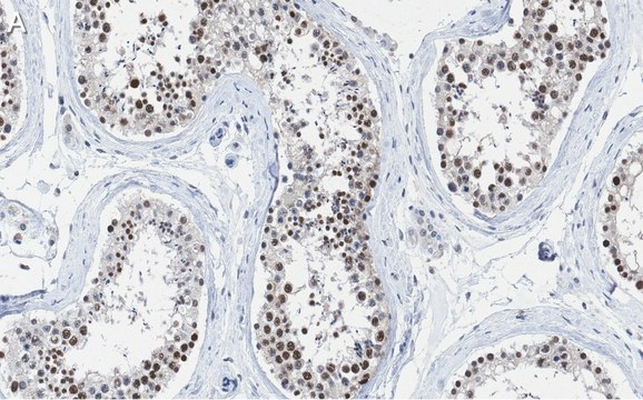 Anti-METTL14 Antibody, clone 2G22 ZooMAb&#174; Rabbit Monoclonal recombinant, expressed in HEK 293 cells