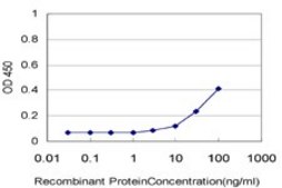Monoclonal Anti-PNPLA2 antibody produced in mouse clone 2H1, purified immunoglobulin, buffered aqueous solution