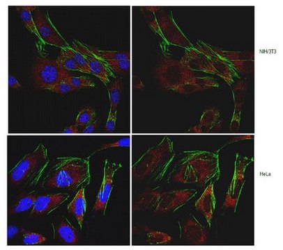 Anti-SDHD (CybS) Antibody from rabbit, purified by affinity chromatography