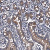 Anti-MAMDC2 antibody produced in rabbit Prestige Antibodies® Powered by Atlas Antibodies, affinity isolated antibody, buffered aqueous glycerol solution, Ab1