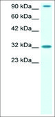 Anti-CIC IgG fraction of antiserum
