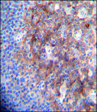 ANTI-MARCO (N-TERM) antibody produced in rabbit IgG fraction of antiserum, buffered aqueous solution