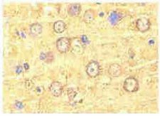 Anti-Nogo Receptor Antibody from rabbit