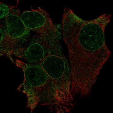 抗T TRAK1 兔抗 Prestige Antibodies&#174; Powered by Atlas Antibodies, affinity isolated antibody