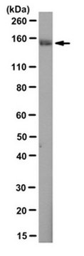 Anti-WHSC1/NSD2 Antibody, clone 29D1 clone 29D1, from mouse