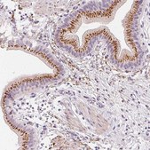 Anti-CHST4 antibody produced in rabbit Prestige Antibodies® Powered by Atlas Antibodies, affinity isolated antibody, buffered aqueous glycerol solution