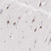 Anti-MNAT1 antibody produced in rabbit affinity isolated antibody, buffered aqueous glycerol solution