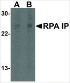 Anti-RPA Interacting Protein (ab1) antibody produced in rabbit affinity isolated antibody, buffered aqueous solution
