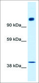Anti-NCOR1 antibody produced in rabbit affinity isolated antibody