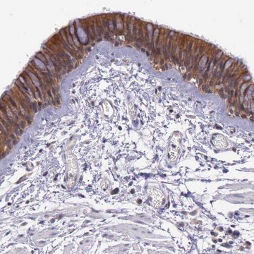 Anti-IGBP1 antibody produced in rabbit Ab2, Prestige Antibodies&#174; Powered by Atlas Antibodies, affinity isolated antibody, buffered aqueous glycerol solution