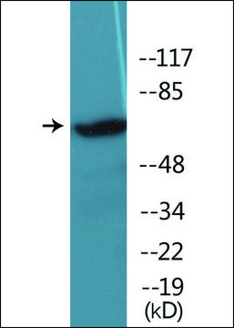 抗 磷酸-IRAK1 (pThr 209 ) 兔抗 affinity isolated antibody