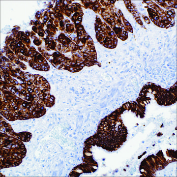 Cytokeratin (OSCAR) Mouse Monoclonal Antibody