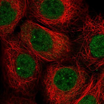 Anti-TNFAIP8 antibody produced in rabbit Prestige Antibodies&#174; Powered by Atlas Antibodies, affinity isolated antibody