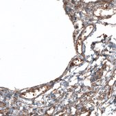 Anti-PIEZO1 antibody produced in rabbit Prestige Antibodies® Powered by Atlas Antibodies, affinity isolated antibody, buffered aqueous glycerol solution
