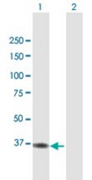 Anti-ACAD8 antibody produced in mouse purified immunoglobulin, buffered aqueous solution